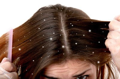 Shampoo Alpecin Dandruff Killer 250ml Unisex - Elimina y Previene la Caspa